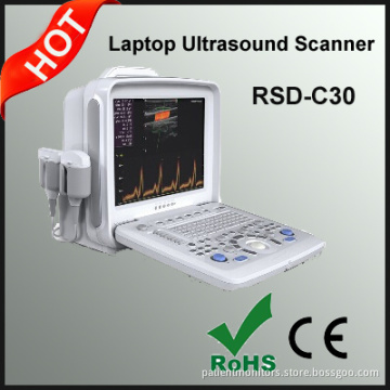 Portable Color Doppler Ultrasonic System